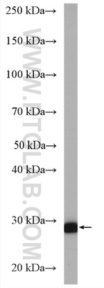PROSC Antibody in Western Blot (WB)