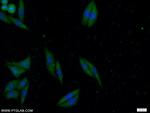 ATG2B Antibody in Immunocytochemistry (ICC/IF)