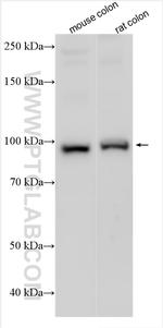 PPP1R12C Antibody in Western Blot (WB)