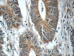 TMEM156 Antibody in Immunohistochemistry (Paraffin) (IHC (P))