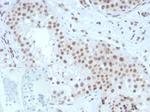 Steroidogenic Factor 1 (SF-1) (Transcription Factor) Monoclonal Antibody (NR5A1/3420)