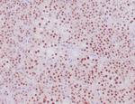 Steroidogenic Factor 1 (SF-1) Recombinant Rabbit Monoclonal Antibody (NR5A1/4368R)
