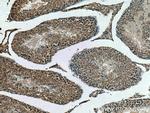 DNAJC18 Antibody in Immunohistochemistry (Paraffin) (IHC (P))