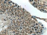DNAJC18 Antibody in Immunohistochemistry (Paraffin) (IHC (P))