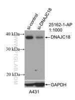 DNAJC18 Antibody in Western Blot (WB)