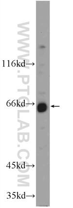 WDR20 Antibody in Western Blot (WB)
