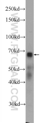 RNF112 Antibody in Western Blot (WB)