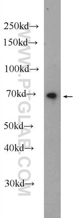 RNF112 Antibody in Western Blot (WB)