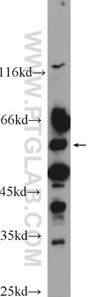 ALDH1A3 Antibody in Western Blot (WB)