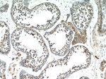 HIVEP1 Antibody in Immunohistochemistry (Paraffin) (IHC (P))