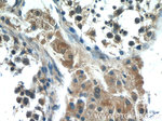 HIVEP1 Antibody in Immunohistochemistry (Paraffin) (IHC (P))