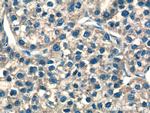 NDUFS8 Antibody in Immunohistochemistry (Paraffin) (IHC (P))