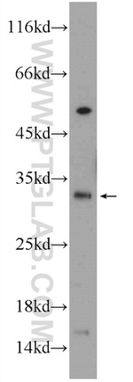 QPRT Antibody in Western Blot (WB)