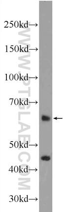 ZNF497 Antibody in Western Blot (WB)