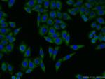 GBF1 Antibody in Immunocytochemistry (ICC/IF)