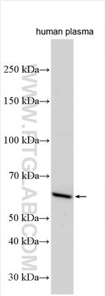 C8B Antibody in Western Blot (WB)