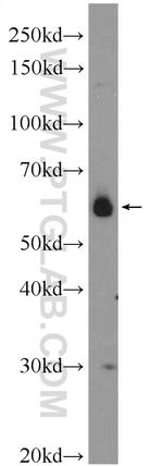 CDC14B Antibody in Western Blot (WB)