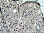 KIAA0125 Antibody in Immunohistochemistry (Paraffin) (IHC (P))