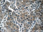 KIAA0125 Antibody in Immunohistochemistry (Paraffin) (IHC (P))