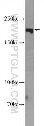 ZCCHC6 Antibody in Western Blot (WB)