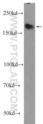 ZCCHC6 Antibody in Western Blot (WB)