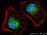 COA1 Antibody in Immunocytochemistry (ICC/IF)