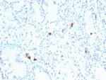 Gastrin Monoclonal Antibody (GAST/2634)
