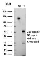 Gastrin Antibody in SDS-PAGE (SDS-PAGE)