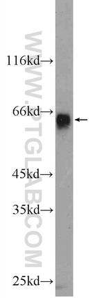 ZIM3 Antibody in Western Blot (WB)