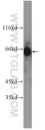 ZIM3 Antibody in Western Blot (WB)