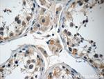 ANKRD33 Antibody in Immunohistochemistry (Paraffin) (IHC (P))