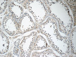 ANKRD33 Antibody in Immunohistochemistry (Paraffin) (IHC (P))