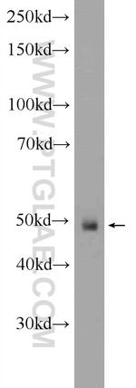 ANKRD33 Antibody in Western Blot (WB)