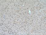DDHD2 Antibody in Immunohistochemistry (Paraffin) (IHC (P))