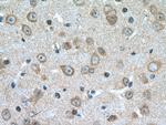 DDHD2 Antibody in Immunohistochemistry (Paraffin) (IHC (P))