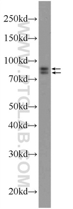 DDHD2 Antibody in Western Blot (WB)