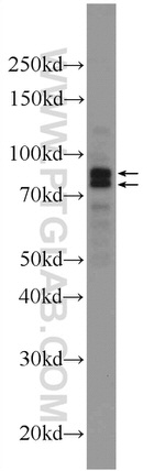 DDHD2 Antibody in Western Blot (WB)