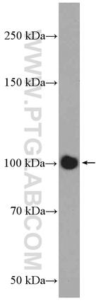 DAAM2 Antibody in Western Blot (WB)