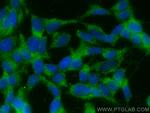 Adropin Antibody in Immunocytochemistry (ICC/IF)
