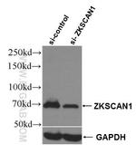 ZKSCAN1 Antibody in Western Blot (WB)