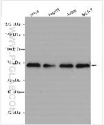 ZKSCAN1 Antibody in Western Blot (WB)