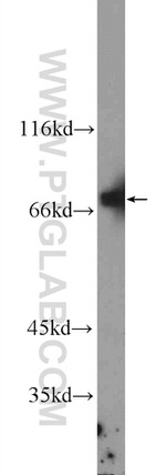 ZKSCAN1 Antibody in Western Blot (WB)