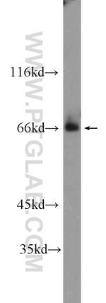 ZKSCAN1 Antibody in Western Blot (WB)
