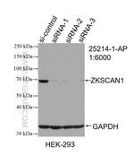 ZKSCAN1 Antibody in Western Blot (WB)