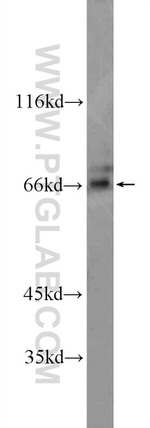 ZKSCAN1 Antibody in Western Blot (WB)