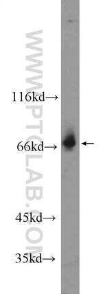 ZKSCAN1 Antibody in Western Blot (WB)