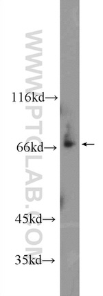 ZKSCAN1 Antibody in Western Blot (WB)