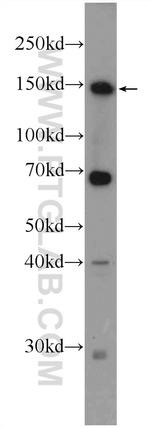 ZBTB11 Antibody in Western Blot (WB)