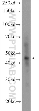 ZNF124 Antibody in Western Blot (WB)