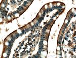 USE1 Antibody in Immunohistochemistry (Paraffin) (IHC (P))